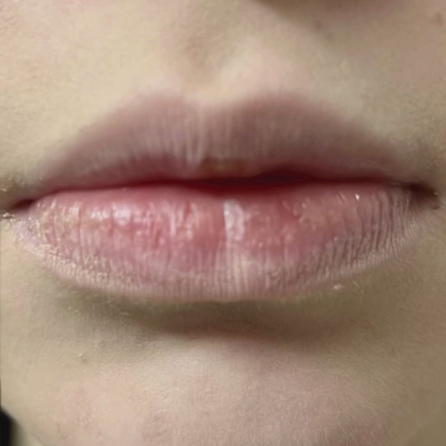 Before and After clip of Lips after Lip Plumper application – Dr. Villy Skincare
