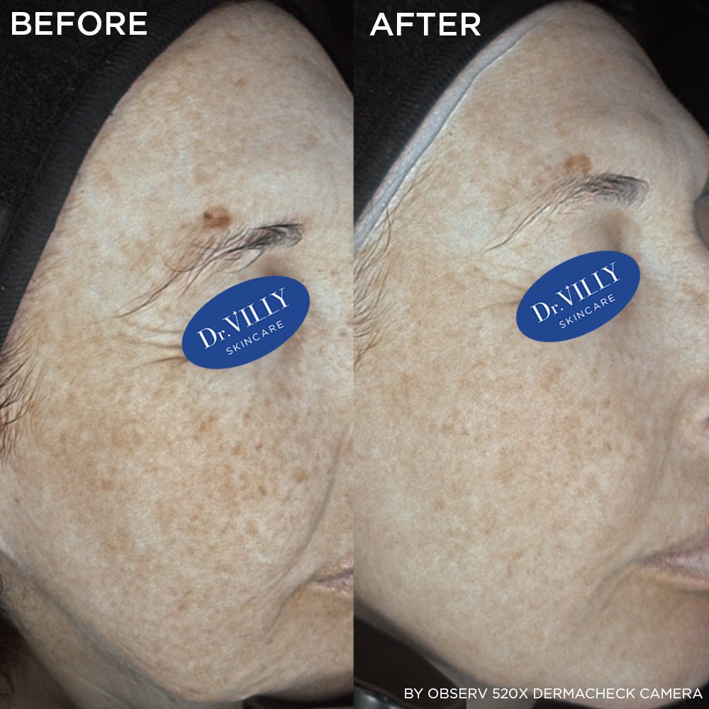 Age Defence - 30ml - Dr. Villy Skincare - Medical Grade product